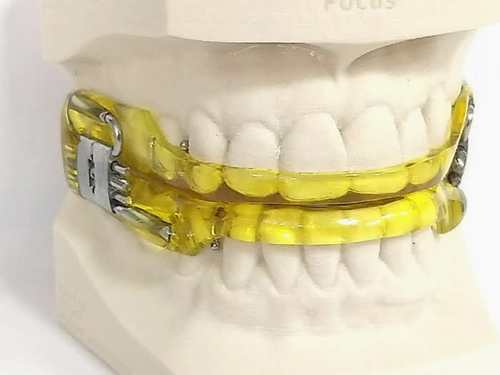 Ronco e Apneia do Sono – Implantes Dentários